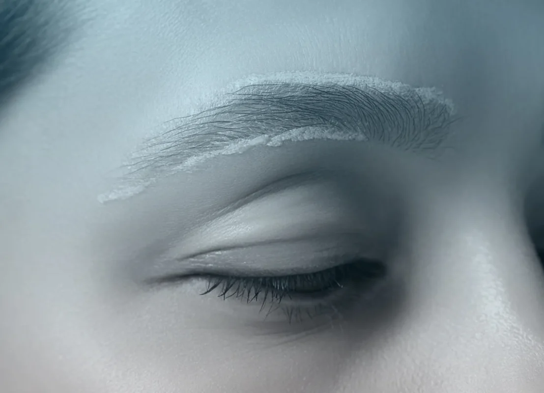 پوسته ریزی بعد از میکروبلیدینگ