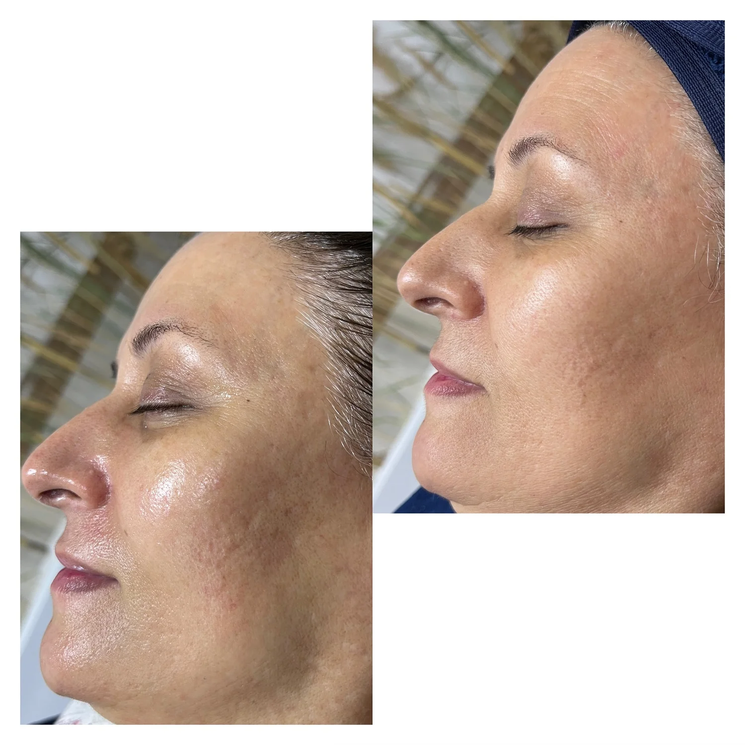 نمونه کار فیشیال