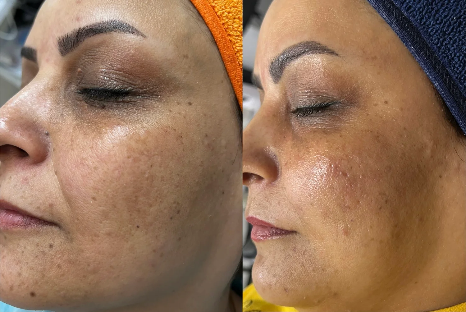 نمونه کار 2 فیشیال